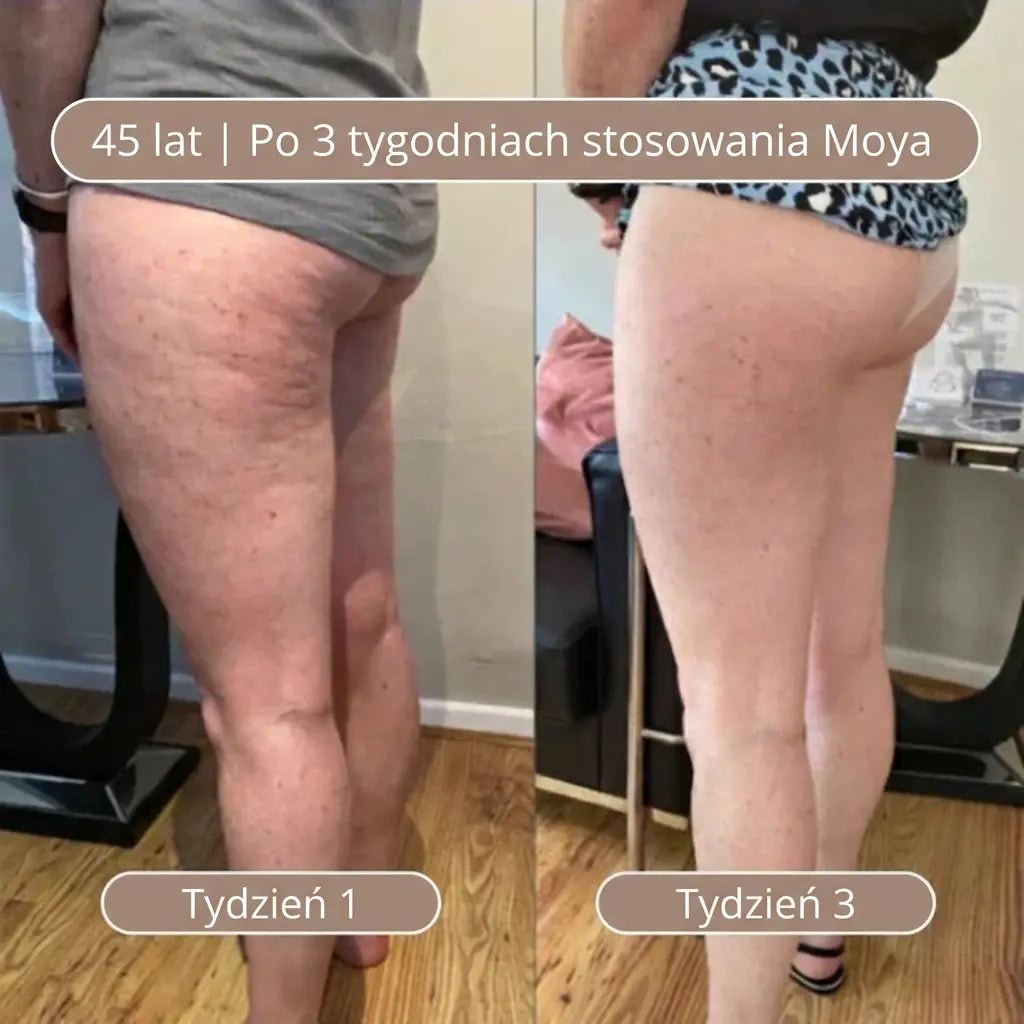 M3 Olejek do masażu antycellulitowego