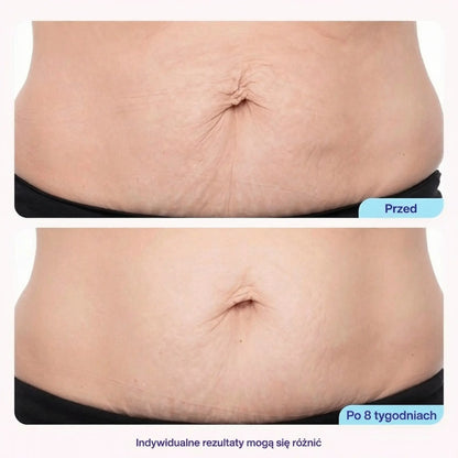 Ujędrniający i wygładzający krem do brzucha